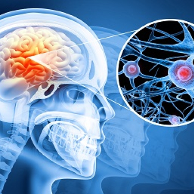 Sport nach Concussion